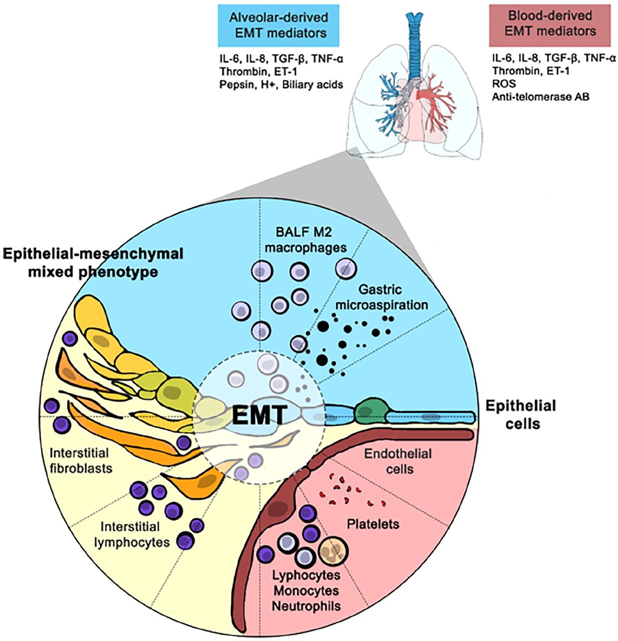 Alveolar epithelial-to-mesenchymal transition in scleroderma ...